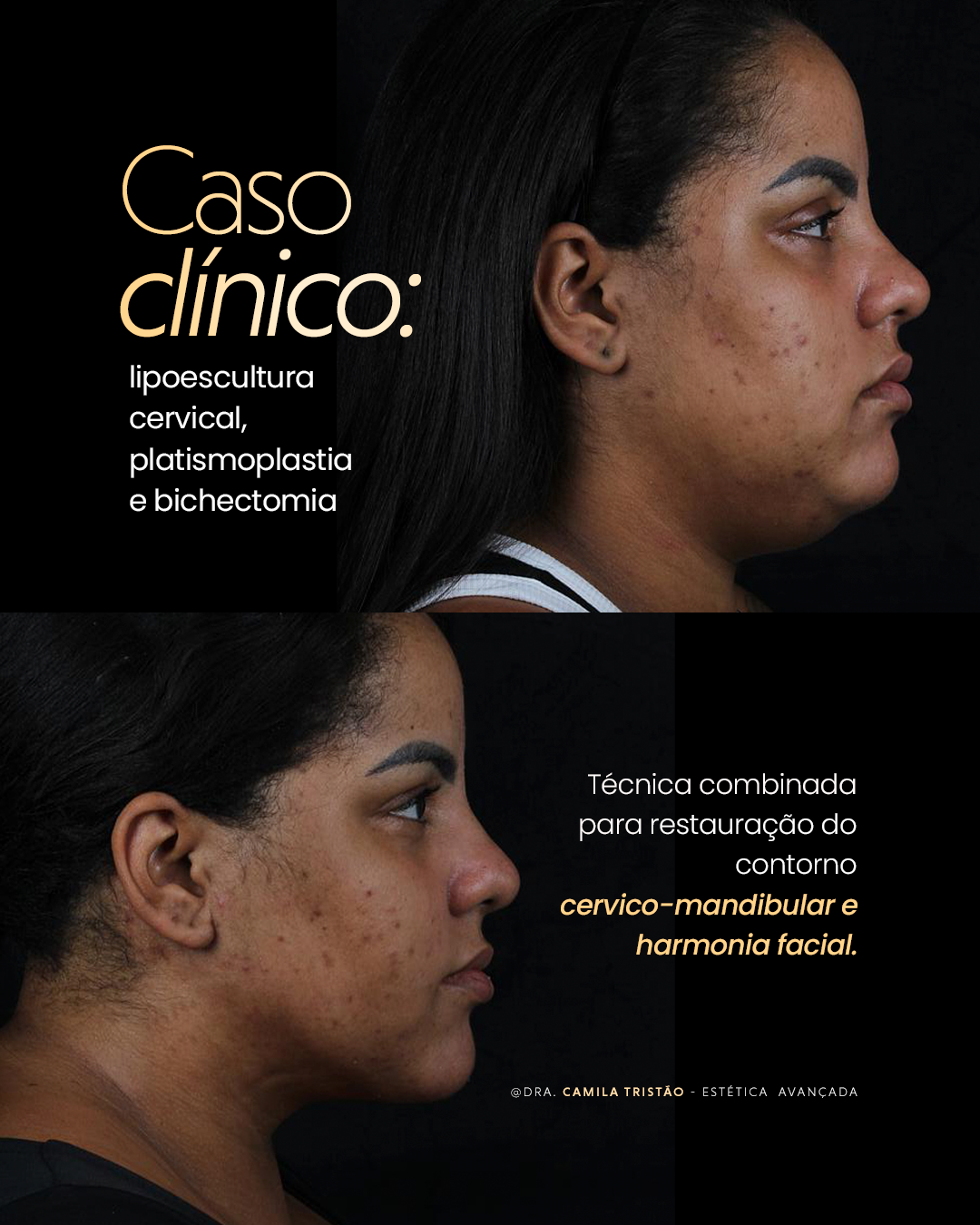 Direção de Conteúdo Premium 08